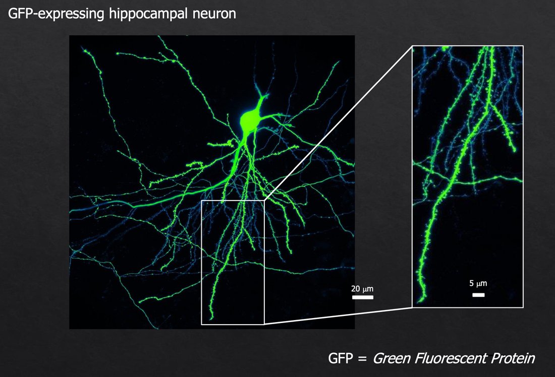 Neurona hipocampal con GFP